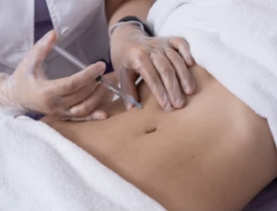 Mesotherapy