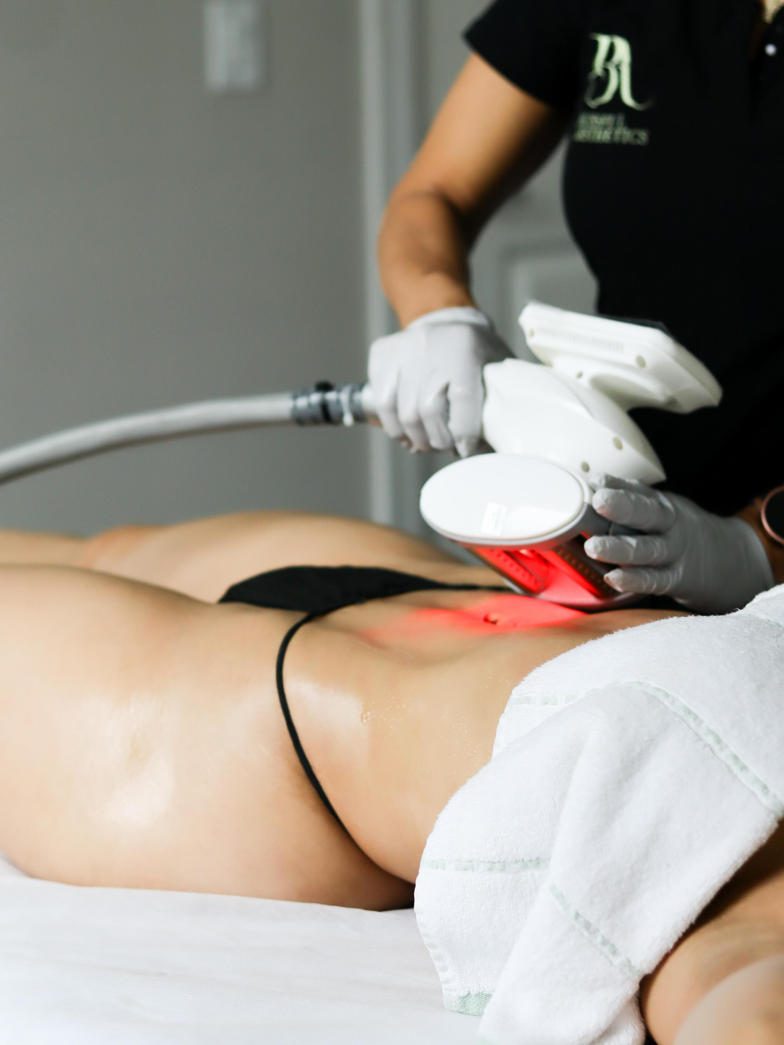 Velashape